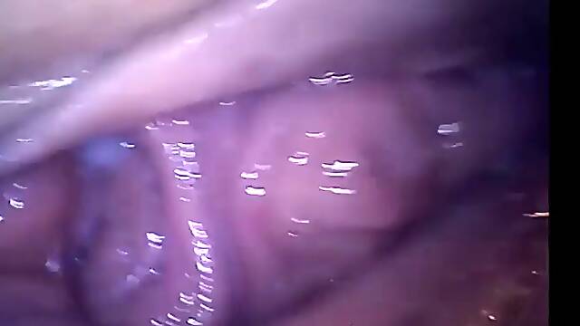 Mirona Amateur, Dentro De Niña, Interior De La Vagina